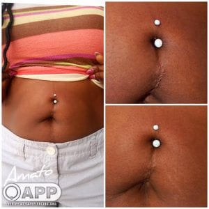 Do I have the wrong anatomy for a belly button piercing? : r/piercing